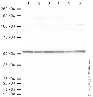 Western blot - Anti-beta IV Tubulin antibody [ONS.1A6] (AB11315)