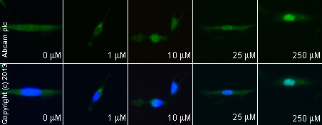 Functional Studies - beta-Lapachone, Topoisomerase I inhibitor (AB141097), expandable thumbnail