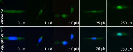 Functional Studies - beta-Lapachone, Topoisomerase I inhibitor (AB141097)