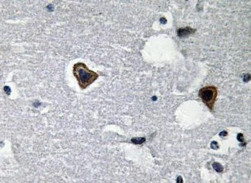 Immunohistochemistry (Formalin/PFA-fixed paraffin-embedded sections) - Anti-beta Sarcoglycan antibody (AB135954)