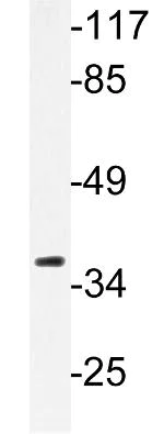 Western blot - Anti-beta Sarcoglycan antibody (AB135954)