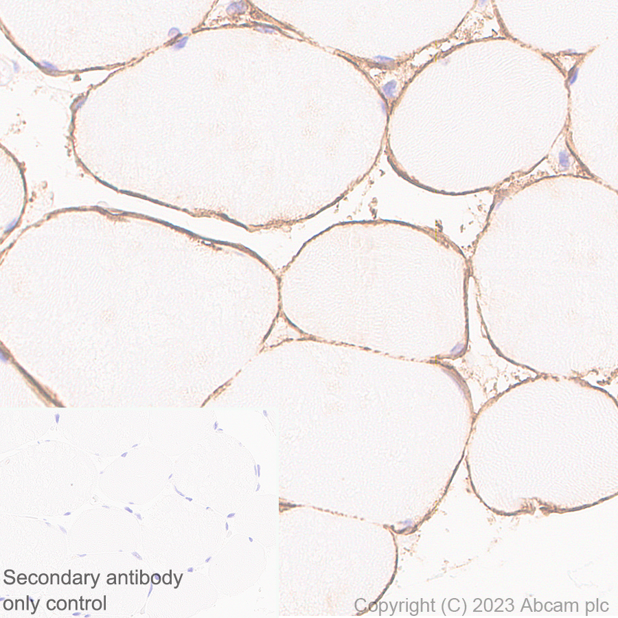 Immunohistochemistry (Formalin/PFA-fixed paraffin-embedded sections) - Anti-beta Sarcoglycan antibody [EPR28175-77] - BSA and Azide free (AB315387)