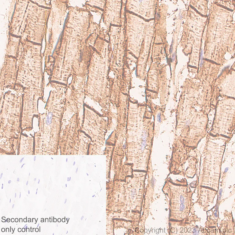 Immunohistochemistry (Formalin/PFA-fixed paraffin-embedded sections) - Anti-beta Sarcoglycan antibody [EPR28175-77] - BSA and Azide free (AB315387)