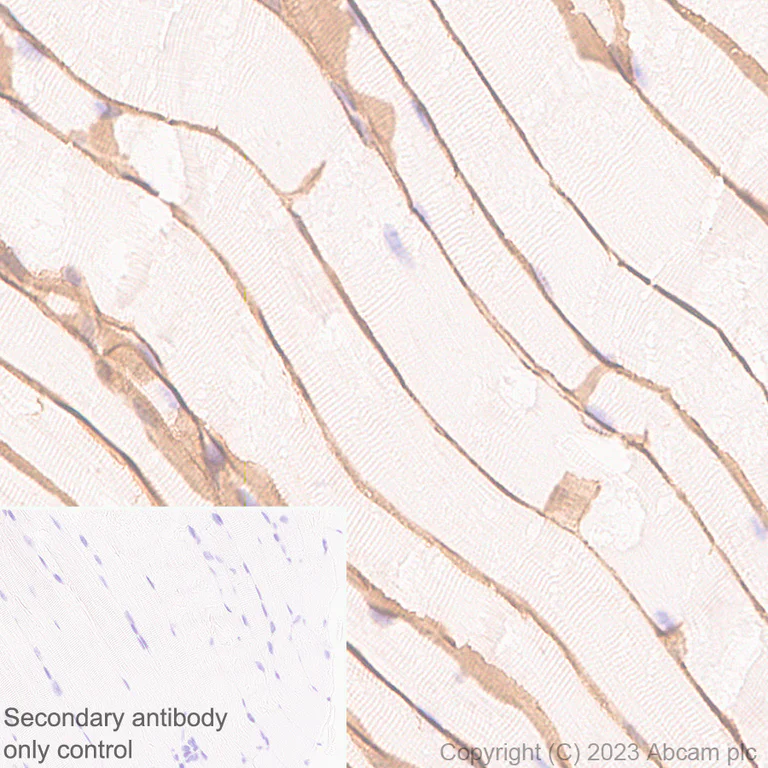 Immunohistochemistry (Formalin/PFA-fixed paraffin-embedded sections) - Anti-beta Sarcoglycan antibody [EPR28175-77] - BSA and Azide free (AB315387)