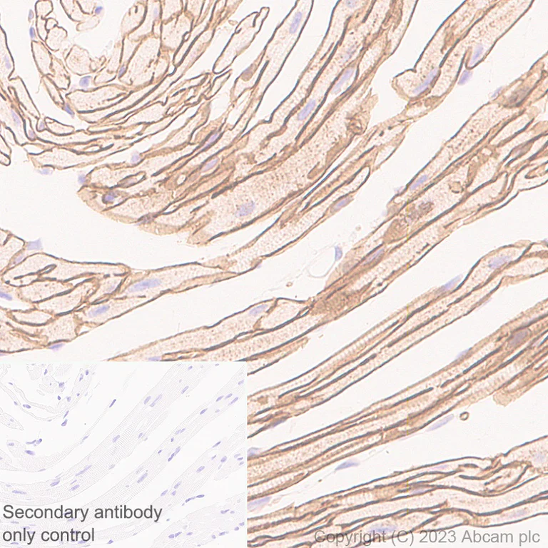 Immunohistochemistry (Formalin/PFA-fixed paraffin-embedded sections) - Anti-beta Sarcoglycan antibody [EPR28175-77] - BSA and Azide free (AB315387)