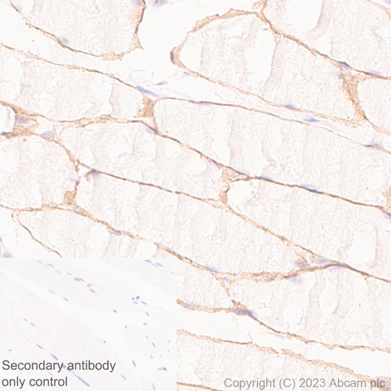 Immunohistochemistry (Formalin/PFA-fixed paraffin-embedded sections) - Anti-beta Sarcoglycan antibody [EPR28175-77] - BSA and Azide free (AB315387)