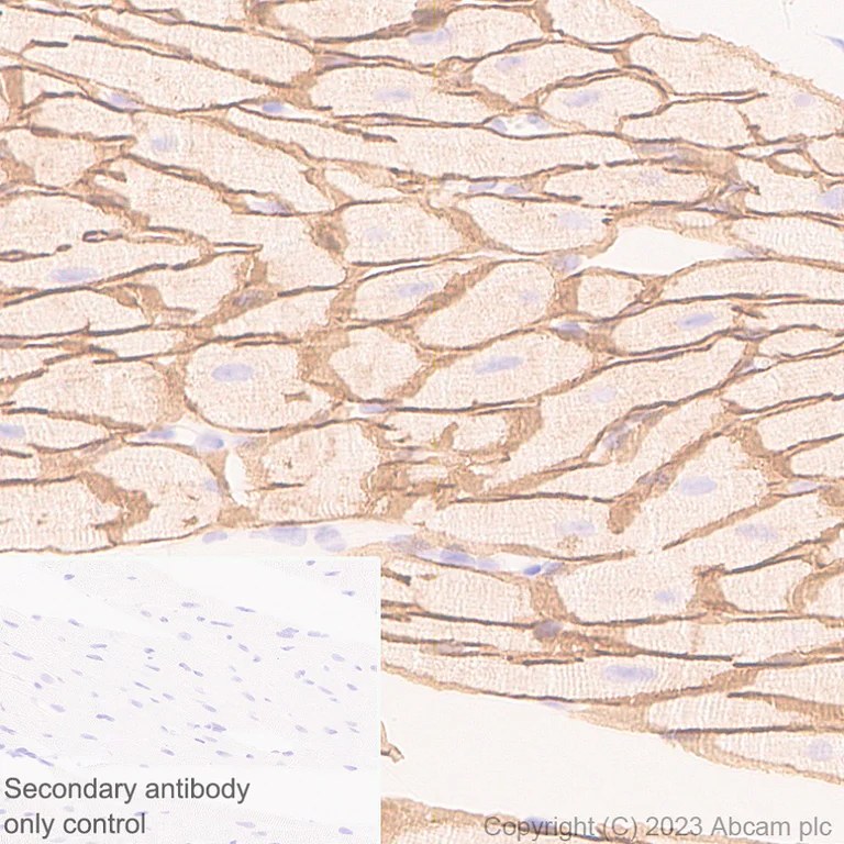 Immunohistochemistry (Formalin/PFA-fixed paraffin-embedded sections) - Anti-beta Sarcoglycan antibody [EPR28175-77] - BSA and Azide free (AB315387)