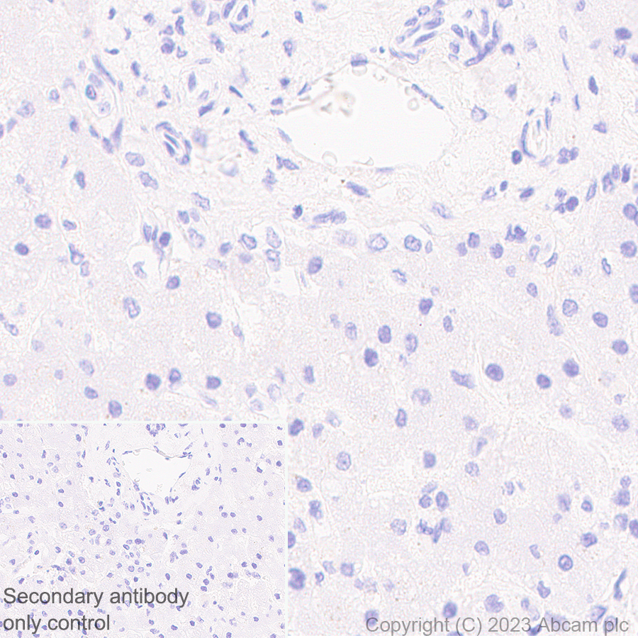 Immunohistochemistry (Formalin/PFA-fixed paraffin-embedded sections) - Anti-beta Sarcoglycan antibody [EPR28175-77] - BSA and Azide free (AB315387)