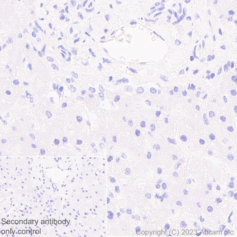 Immunohistochemistry (Formalin/PFA-fixed paraffin-embedded sections) - Anti-beta Sarcoglycan antibody [EPR28175-77] - BSA and Azide free (AB315387)