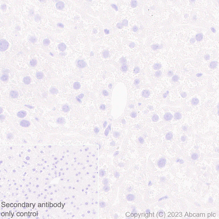 Immunohistochemistry (Formalin/PFA-fixed paraffin-embedded sections) - Anti-beta Sarcoglycan antibody [EPR28175-77] - BSA and Azide free (AB315387)