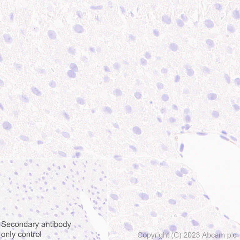 Immunohistochemistry (Formalin/PFA-fixed paraffin-embedded sections) - Anti-beta Sarcoglycan antibody [EPR28175-77] - BSA and Azide free (AB315387)