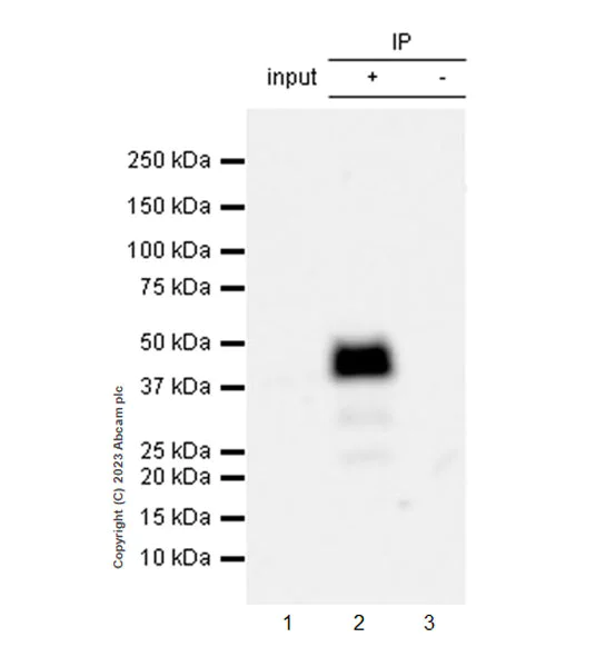 Immunoprecipitation - Anti-beta Sarcoglycan antibody [EPR28175-77] - BSA and Azide free (AB315387)