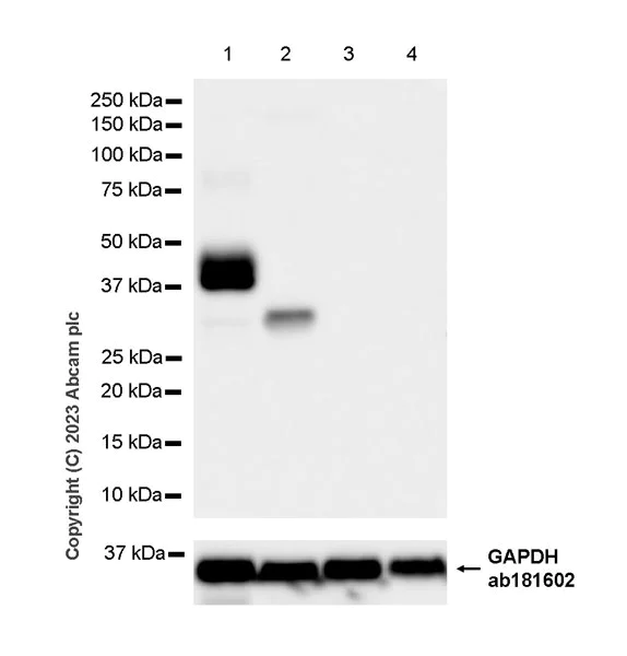 Western blot - Anti-beta Sarcoglycan antibody [EPR28175-77] - BSA and Azide free (AB315387)