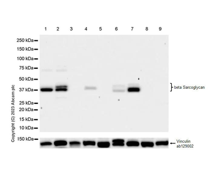 Western blot - Anti-beta Sarcoglycan antibody [EPR28175-77] - BSA and Azide free (AB315387)