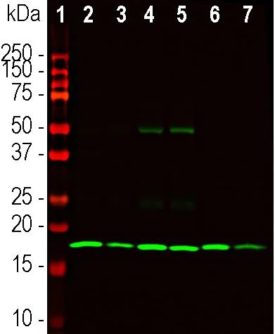 Western blot - Anti-beta Synuclein antibody [6A10] (AB277630)