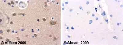 Immunohistochemistry (Formalin/PFA-fixed paraffin-embedded sections) - Anti-beta Synuclein antibody (AB6165)
