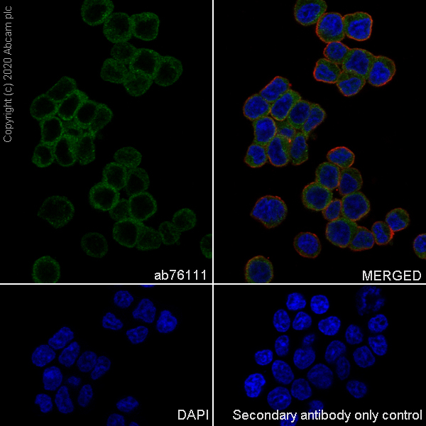 Immunocytochemistry/ Immunofluorescence - Anti-beta Synuclein antibody [EP1537Y] (ab76111), expandable thumbnail