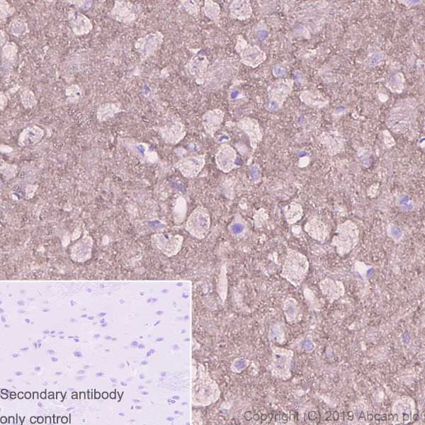 Immunohistochemistry (Formalin/PFA-fixed paraffin-embedded sections) - Anti-beta Synuclein antibody [EP1537Y] (ab76111), expandable thumbnail