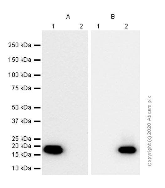 Western blot - Anti-beta Synuclein antibody [EP1537Y] (AB76111), expandable thumbnail