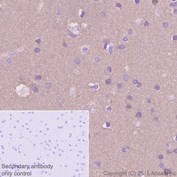 Immunohistochemistry (Formalin/PFA-fixed paraffin-embedded sections) - Anti-beta Synuclein antibody [EP1537Y] - BSA and Azide free (AB221908), expandable thumbnail