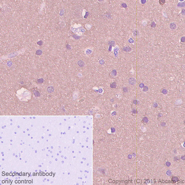 Immunohistochemistry (Formalin/PFA-fixed paraffin-embedded sections) - Anti-beta Synuclein antibody [EP1537Y] - BSA and Azide free (AB221908)