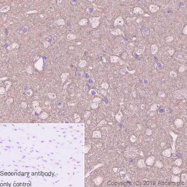 Immunohistochemistry (Formalin/PFA-fixed paraffin-embedded sections) - Anti-beta Synuclein antibody [EP1537Y] - BSA and Azide free (AB221908)