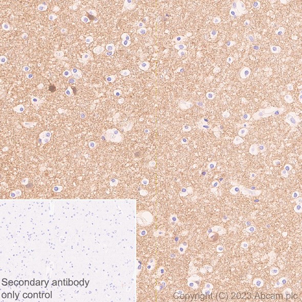Immunohistochemistry (Formalin/PFA-fixed paraffin-embedded sections) - Anti-beta Synuclein antibody [EP1537Y] - BSA and Azide free (ab221908), expandable thumbnail