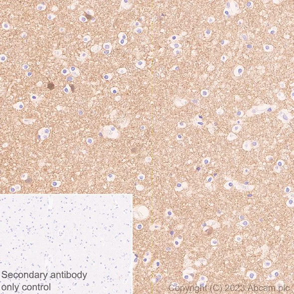 Immunohistochemistry (Formalin/PFA-fixed paraffin-embedded sections) - Anti-beta Synuclein antibody [EP1537Y] - BSA and Azide free (AB221908)