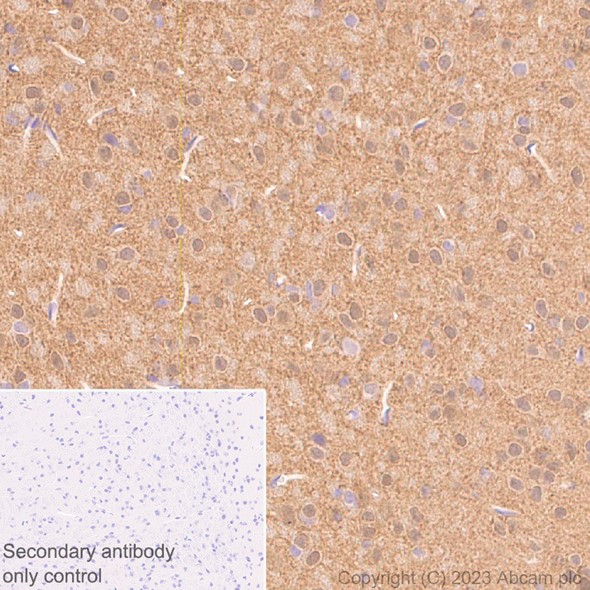 Immunohistochemistry (Formalin/PFA-fixed paraffin-embedded sections) - Anti-beta Synuclein antibody [EP1537Y] - BSA and Azide free (ab221908), expandable thumbnail