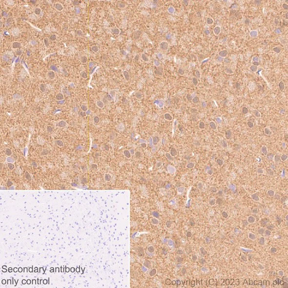 Immunohistochemistry (Formalin/PFA-fixed paraffin-embedded sections) - Anti-beta Synuclein antibody [EP1537Y] - BSA and Azide free (AB221908)