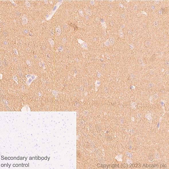 Immunohistochemistry (Formalin/PFA-fixed paraffin-embedded sections) - Anti-beta Synuclein antibody [EP1537Y] - BSA and Azide free (ab221908), expandable thumbnail