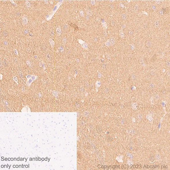 Immunohistochemistry (Formalin/PFA-fixed paraffin-embedded sections) - Anti-beta Synuclein antibody [EP1537Y] - BSA and Azide free (AB221908)