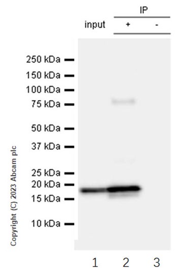 Immunoprecipitation - Anti-beta Synuclein antibody [EP1537Y] - BSA and Azide free (ab221908), expandable thumbnail