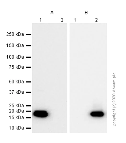 Western blot - Anti-beta Synuclein antibody [EP1537Y] - BSA and Azide free (AB221908)