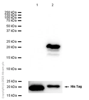 Western blot - Anti-beta Synuclein antibody [EP1537Y] - BSA and Azide free (AB221908)