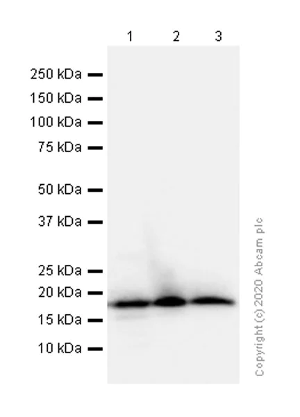 Western blot - Anti-beta Synuclein antibody [EP1537Y] - BSA and Azide free (AB221908)