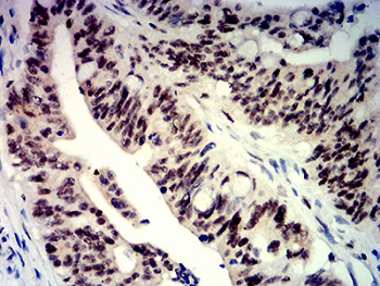 Immunohistochemistry (Formalin/PFA-fixed paraffin-embedded sections) - Anti-Beta TRCP antibody [3D5E6] (AB233739)