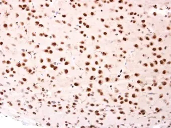 Immunohistochemistry (Formalin/PFA-fixed paraffin-embedded sections) - Anti-Beta TRCP antibody (AB137674)
