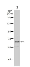 Western blot - Anti-Beta TRCP antibody (AB137674)