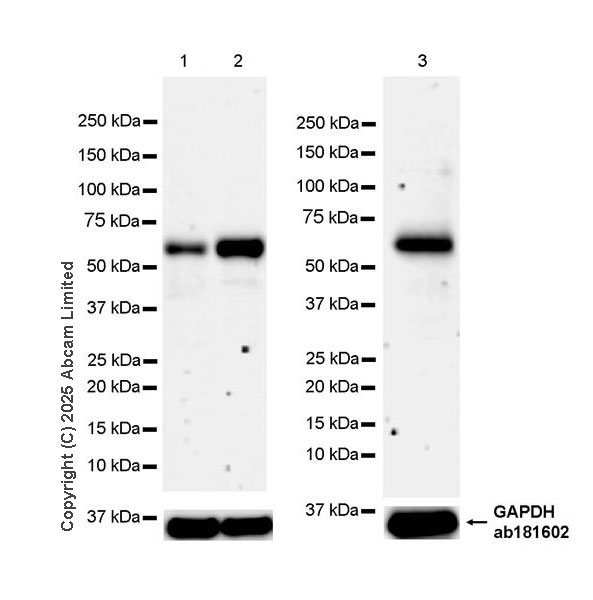 Western blot - Anti-Beta TRCP/HOS antibody [EPR25381-38] (AB324049), expandable thumbnail