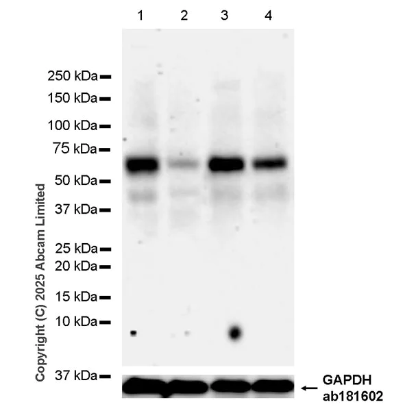 Western blot - Anti-Beta TRCP/HOS antibody [EPR25381-38] (AB324049)