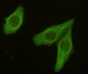 Immunocytochemistry/ Immunofluorescence - Anti-beta Tubulin antibody [1E1-E8-H4] - Microtubule Marker (AB131205), expandable thumbnail