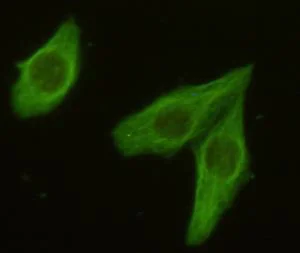Immunocytochemistry/ Immunofluorescence - Anti-beta Tubulin antibody [1E1-E8-H4] - Loading Control (AB131205)