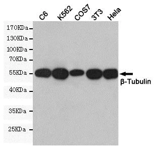 Western blot - Anti-beta Tubulin antibody [1E1-E8-H4] - Loading Control (AB131205)