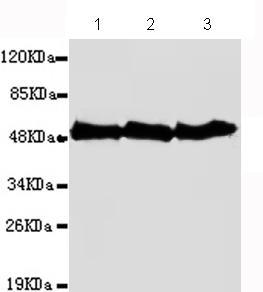Western blot - Anti-beta Tubulin antibody [1E1-E8-H4] - Loading Control (AB131205), expandable thumbnail