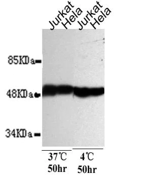 Western blot - Anti-beta Tubulin antibody [1E1-E8-H4] - Loading Control (AB131205)