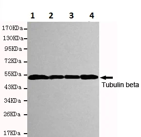Western blot - Anti-beta Tubulin antibody [1E1-E8-H4] - Loading Control (AB131205)