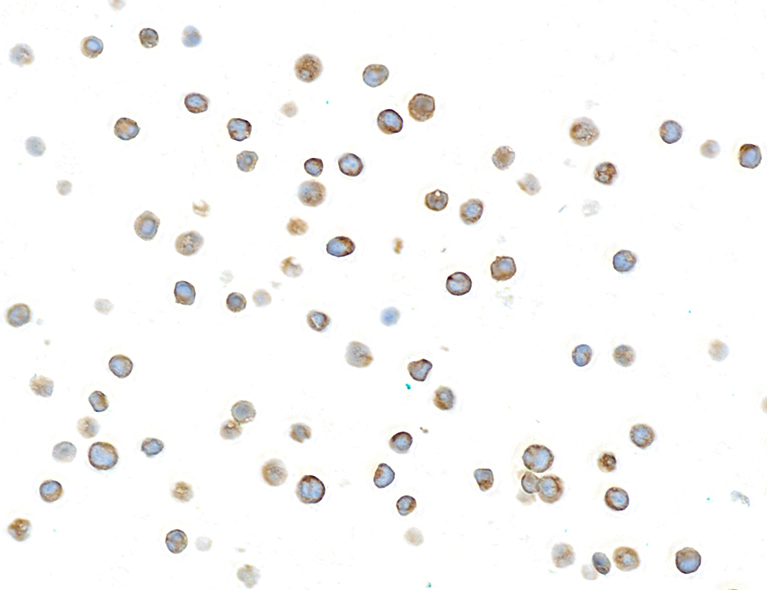 Immunocytochemistry - Anti-beta-Tubulin antibody [BLR236K] - BSA free (ab314069), expandable thumbnail
