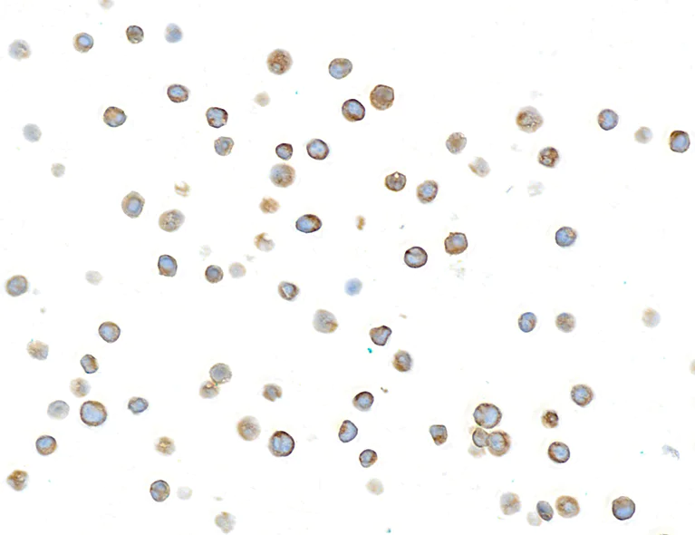 Immunocytochemistry - Anti-beta-Tubulin antibody [BLR236K] - BSA free (AB314069)