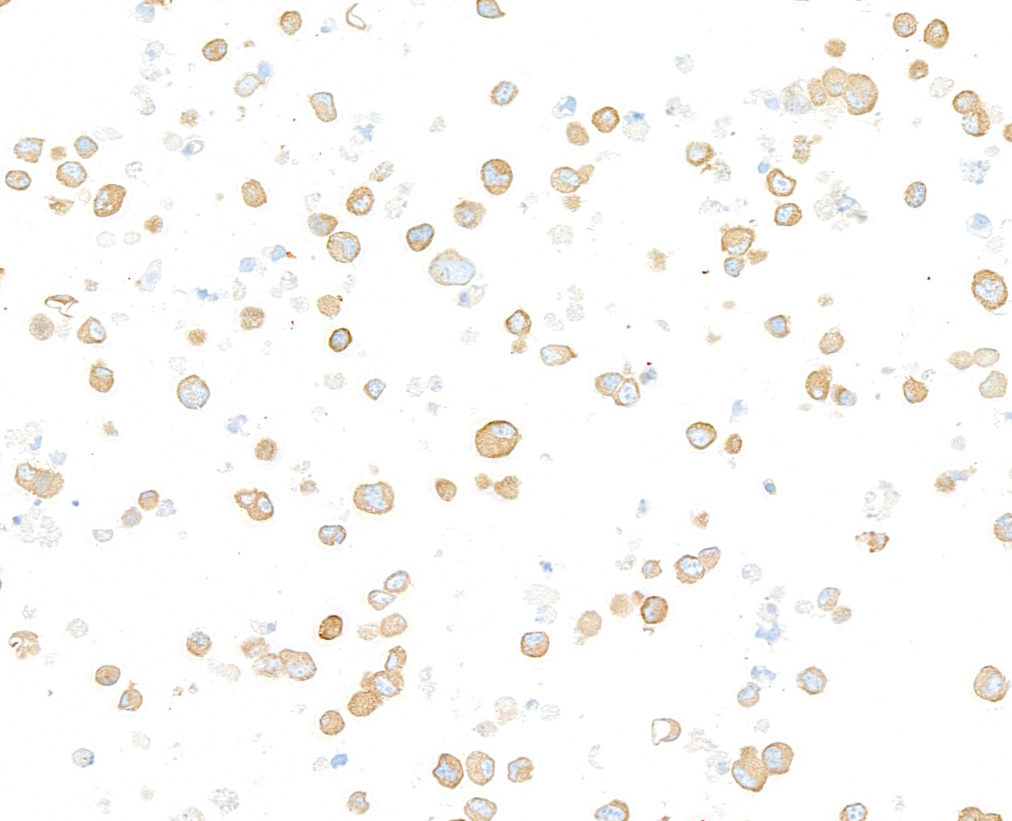 Immunocytochemistry - Anti-beta-Tubulin antibody [BLR236K] - BSA free (ab314069), expandable thumbnail